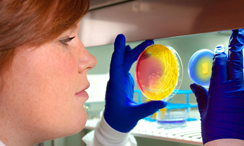 Researcher with petri dishes